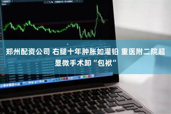 郑州配资公司 右腿十年肿胀如灌铅 重医附二院超显微手术卸“包袱”